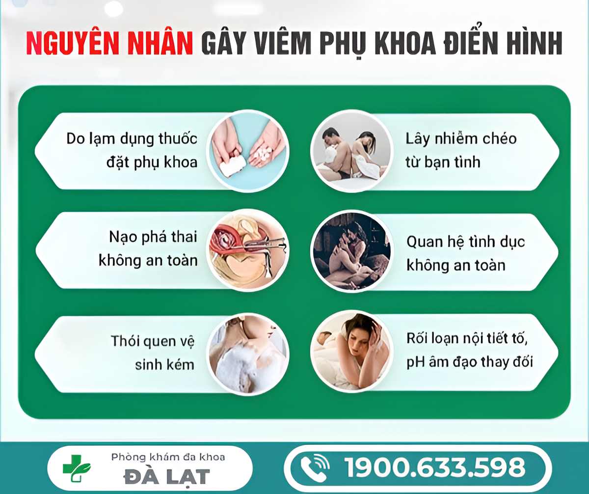 Hình ảnh minh họa